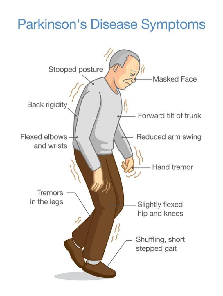 5 Stages Of Parkinsons Disease Livewell Private Care 