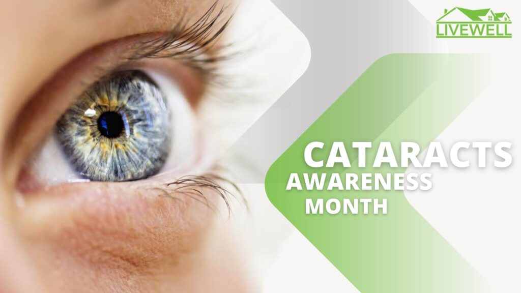 Cataracts in Children