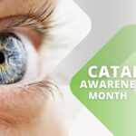 Cataracts in Children