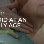 Thyroid management at an elderly age - things to do